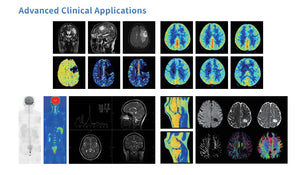 Zero Helium Full Freedom MRI System